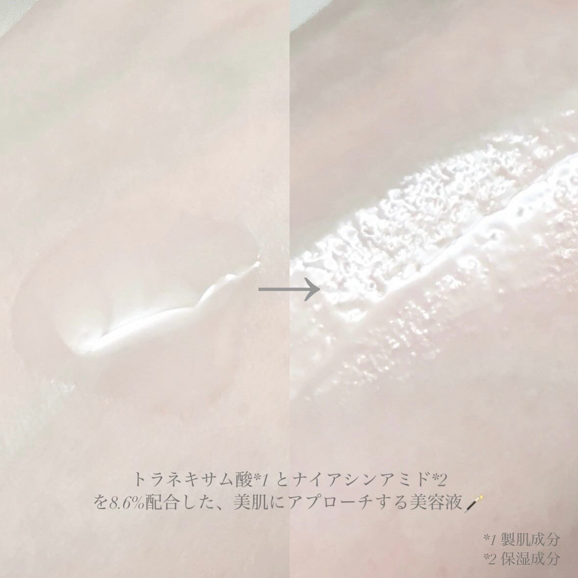 TX-Cream/Dr.Melaxin/フェイスクリームを使ったクチコミ(5枚目)