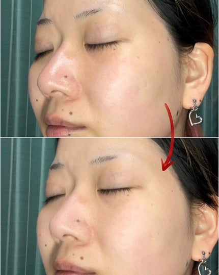 ãµã çŽ èèšå¿µæ¥ è¬çšã¹ãã³ã±ã¢ããŠã㌠ACãã¯ã€ããå»è¬éšå€åã/çŽ èèšå¿µæ¥/ãã¬ã¹ãããŠããŒã䜿ã£ãã¯ãã³ãïŒ7æç®ïŒ