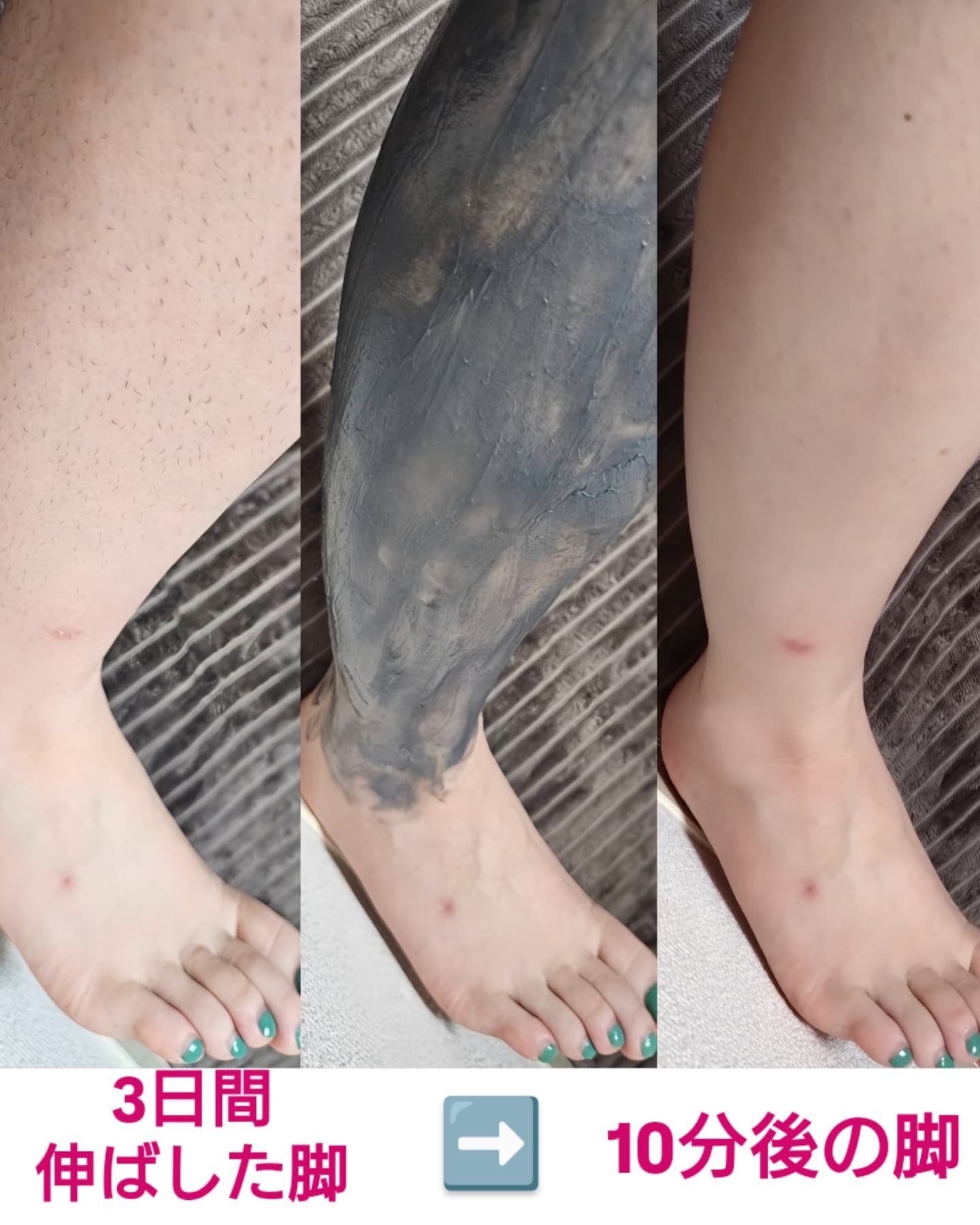 除毛クリーム/MenzBasic/除毛クリームを使ったクチコミ（2枚目）