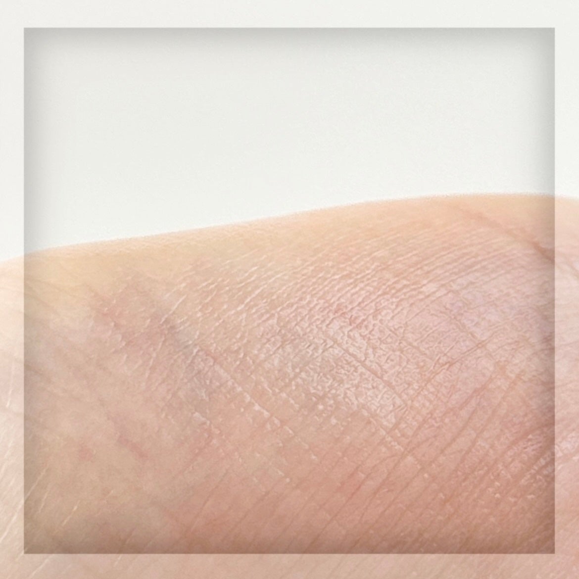 ダーマアンサーアゼライン酸ミントアンプル/CNP Laboratory/美容液を使ったクチコミ(5枚目)