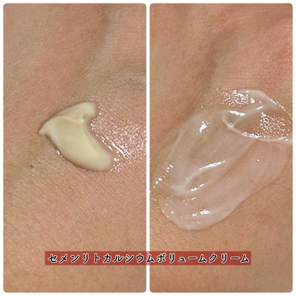 セメンリトカルシウムアンプル+セメンリトカルシウムクリーム/Dr.Melaxin/スキンケアキットを使ったクチコミ(6枚目)