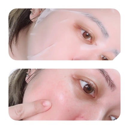 ドクタージー バクチオールポアジェット クイックタイトニングマスク/Dr.G/シートマスク・パックを使ったクチコミ(3枚目)