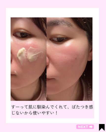 セメンリトカルシウムアンプル+セメンリトカルシウムクリーム/Dr.Melaxin/スキンケアキットを使ったクチコミ(8枚目)