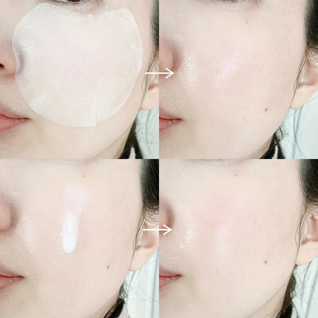 センテラ クイックカーミングパッド/SKIN1004/トナーパッドを使ったクチコミ(6枚目)