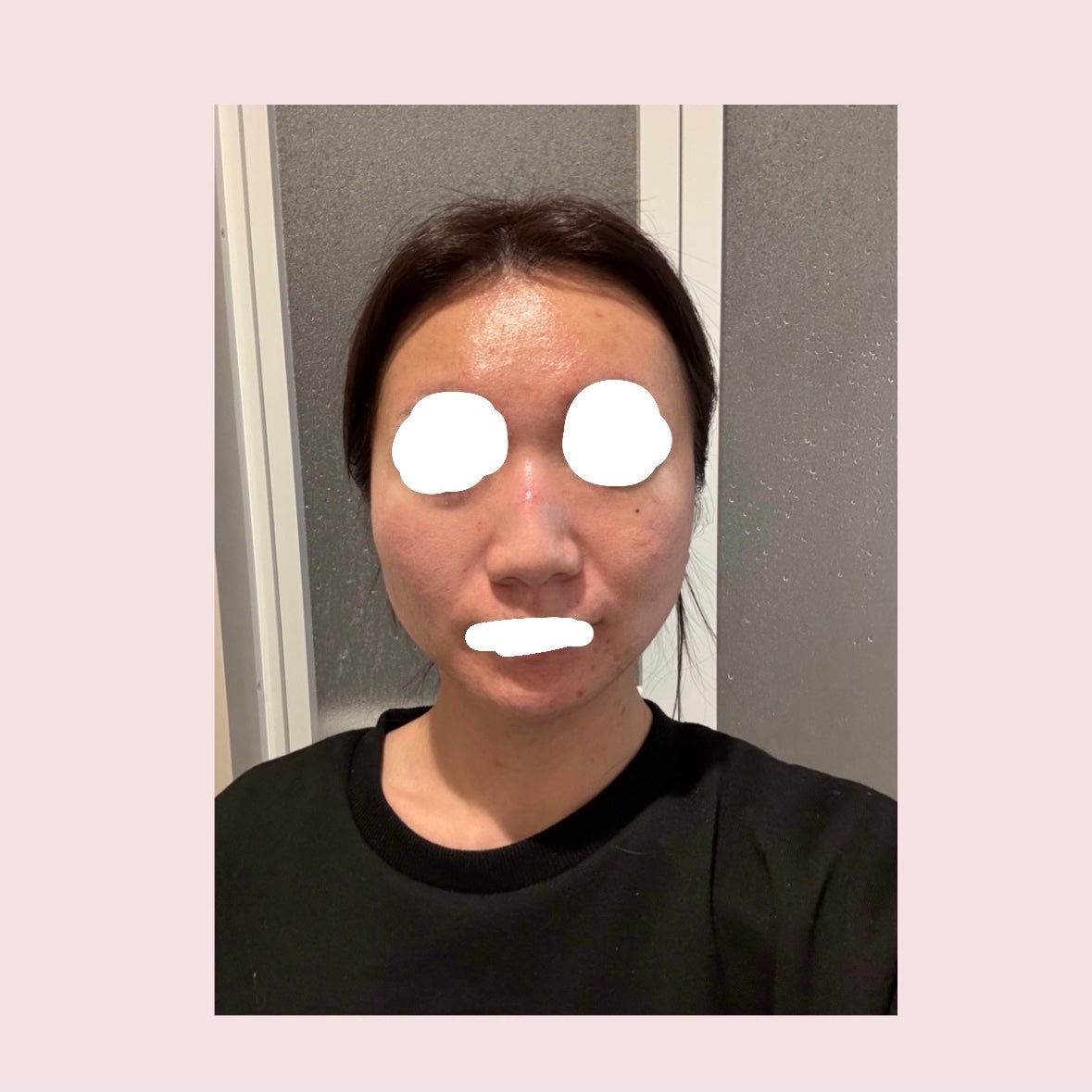 薬用Cクリアクレンジングジェル/ドクターケイ/クレンジングジェルを使ったクチコミ(5枚目)