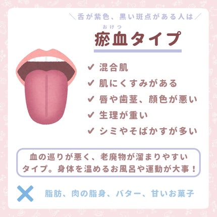 コンクールF/ウエルテック/マウスウォッシュ・スプレーを使ったクチコミ(5枚目)