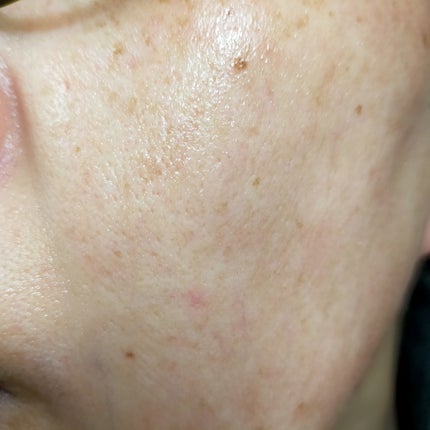 PDRNデイリーマスクパック/COSNORI/その他スキンケアを使ったクチコミ(4枚目)