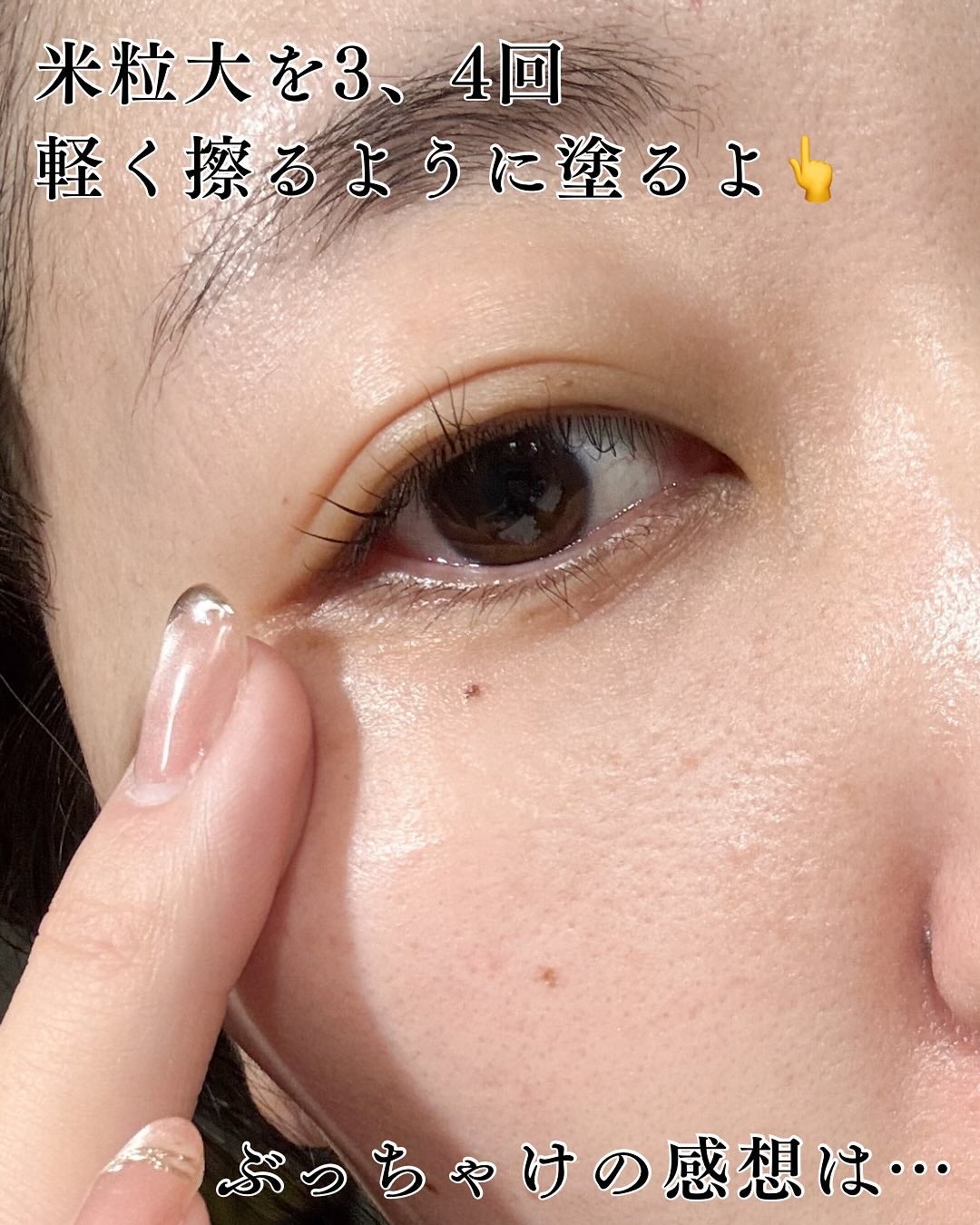 アイファルトアイバッククリーム/Dr.Melaxin/アイケア・アイクリームを使ったクチコミ(4枚目)