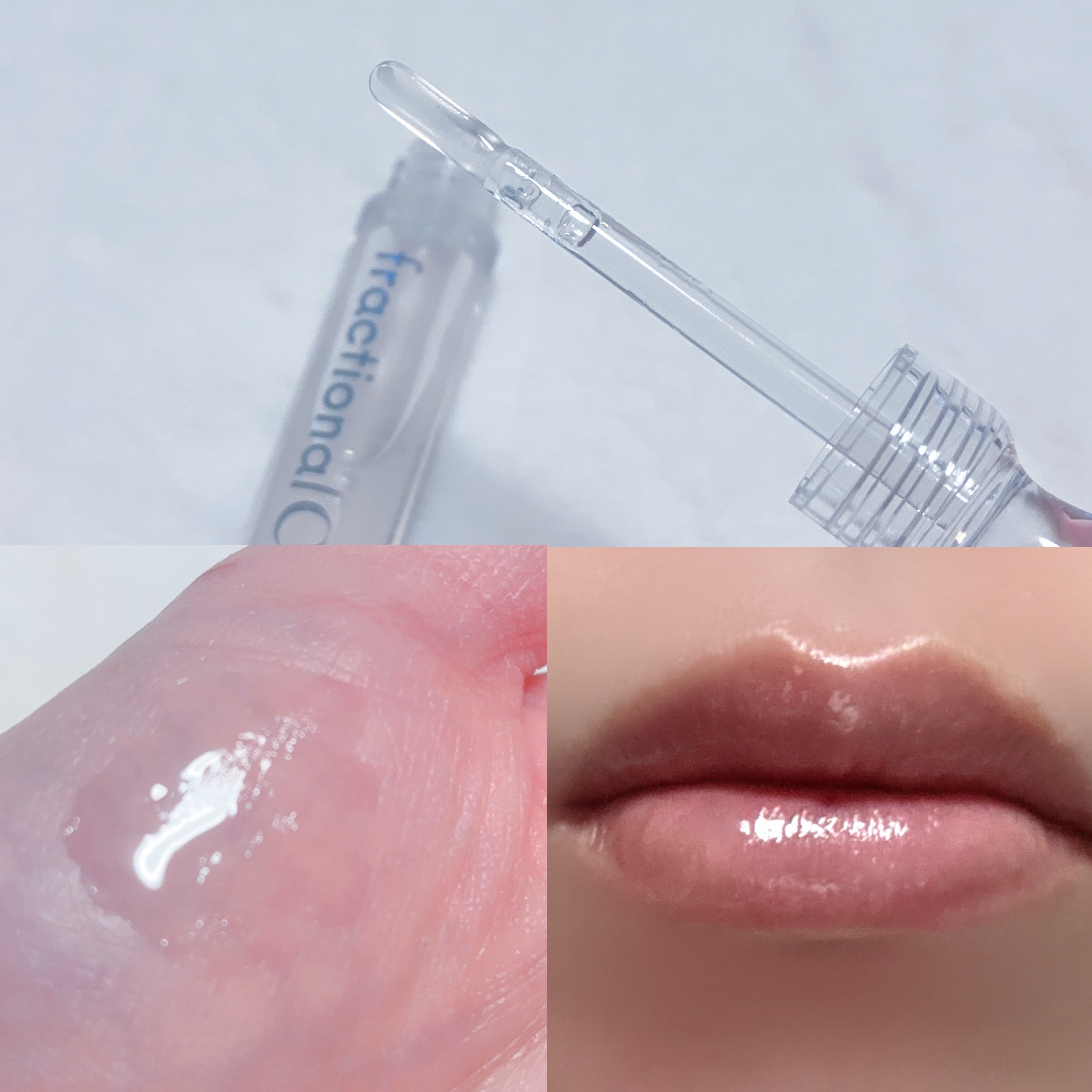 PDRNショット リッププランパー/fractionalCC/リッププランパーを使ったクチコミ（2枚目）