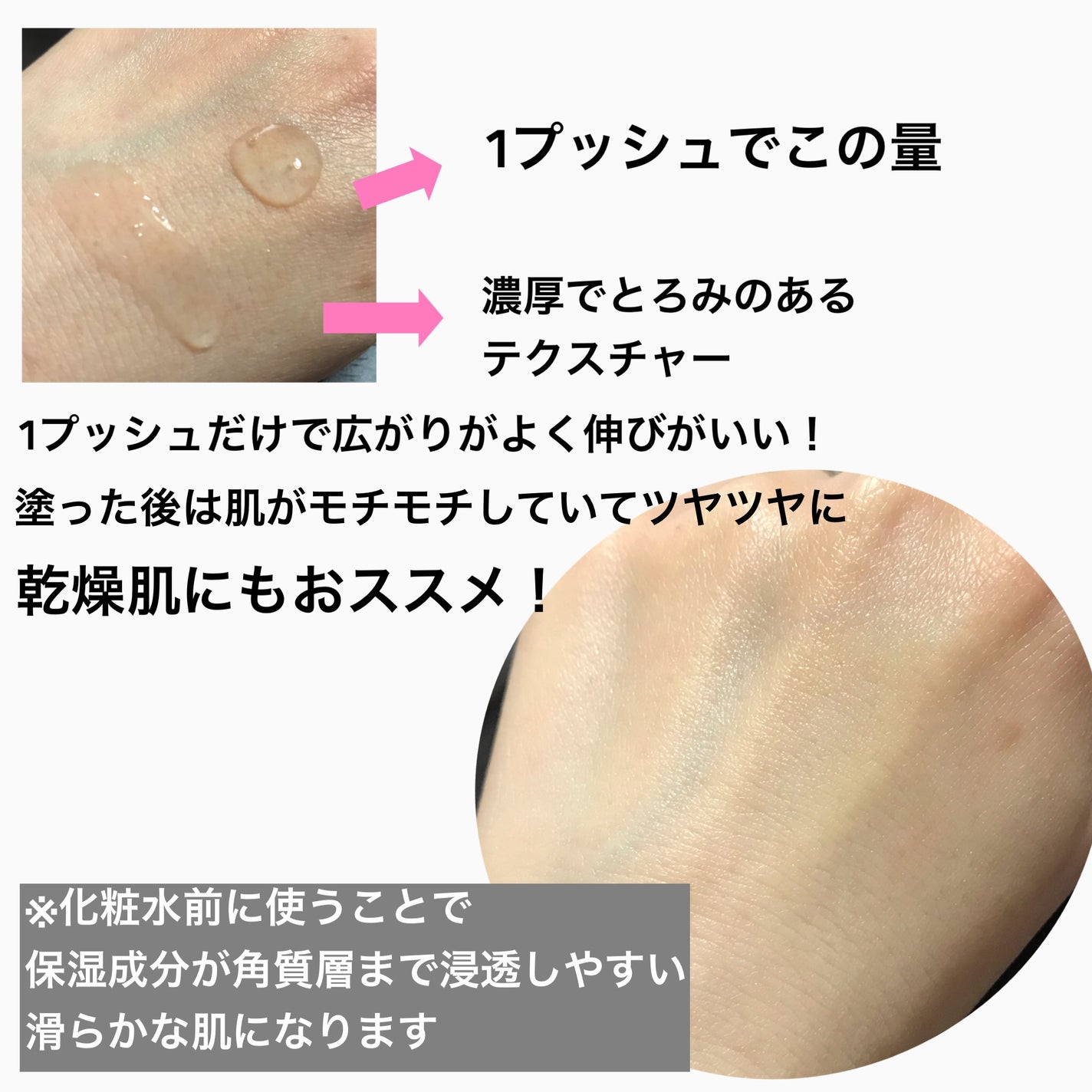 çºé
µå°å
¥çŸå®¹æ¶²/ç¡å°è¯å/ããŒã¹ã¿ãŒã»å°å
¥æ¶²ã䜿ã£ãã¯ãã³ãïŒ3æç®ïŒ