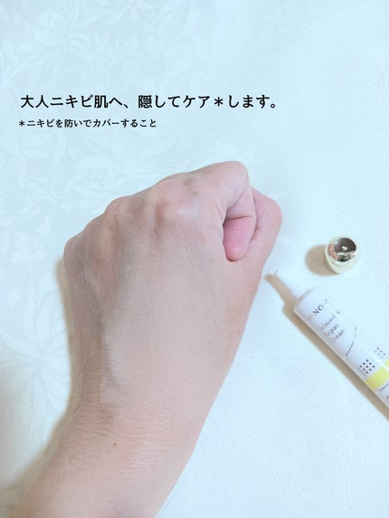 イプノス シーバムクリア リペアクリーム/ACSEINE/フェイスクリームを使ったクチコミ(4枚目)