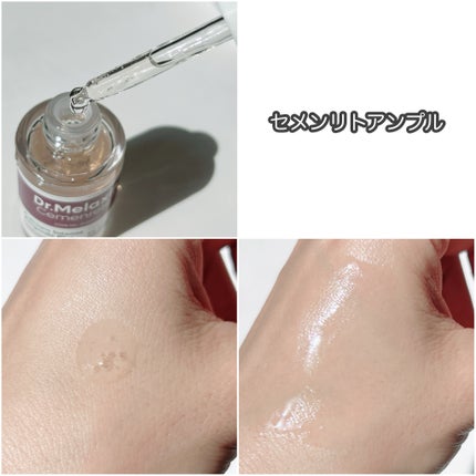 Cemenrete Calcium Intense Cream/Dr.Melaxin/フェイスクリームを使ったクチコミ(3枚目)