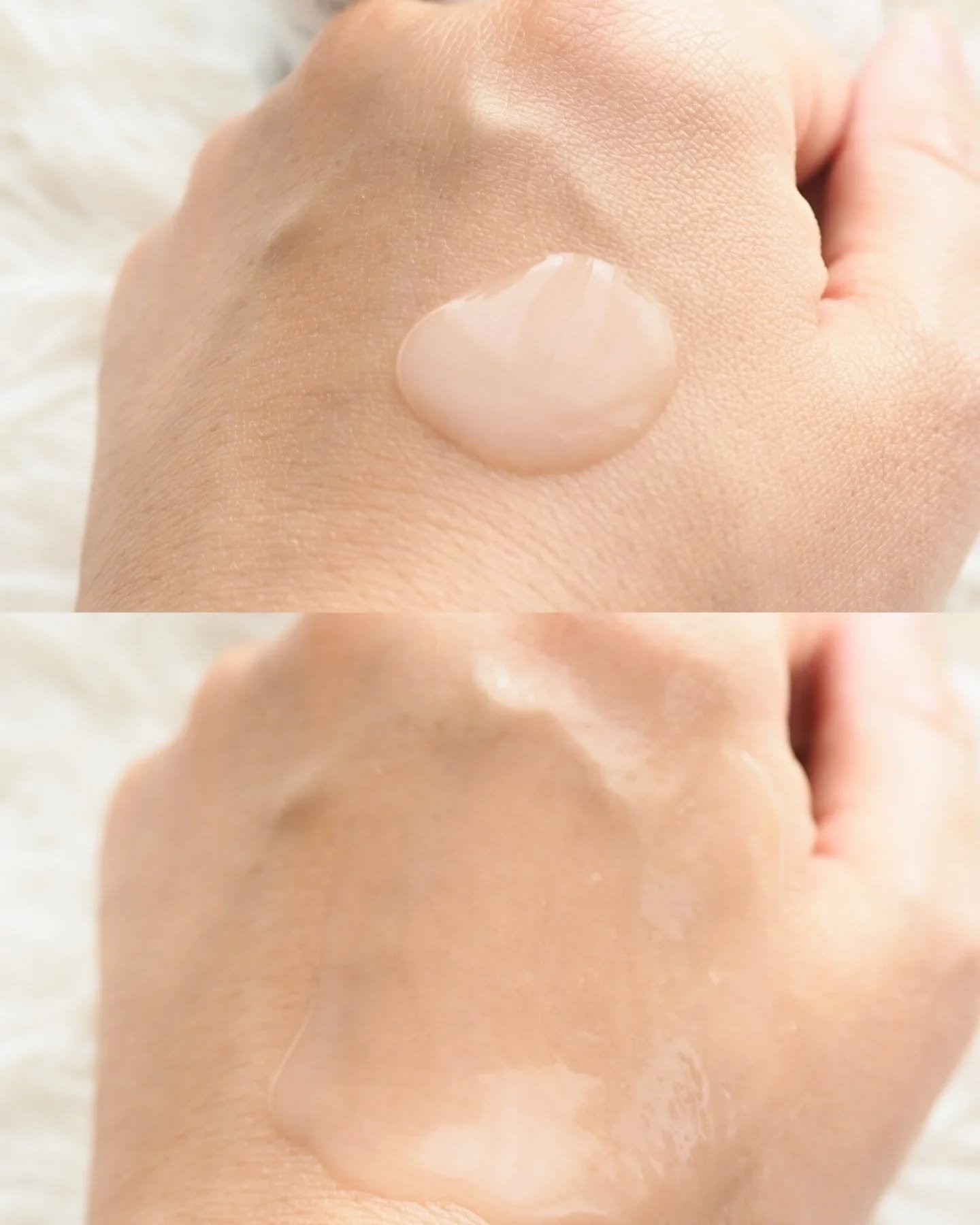 TXアンプルRX＋TXクリーム/Dr.Melaxin/スキンケアキットを使ったクチコミ（3枚目）