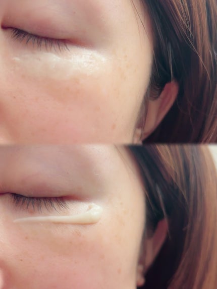 アイファルトアイバッククリーム/Dr.Melaxin/アイケア・アイクリームを使ったクチコミ(4枚目)