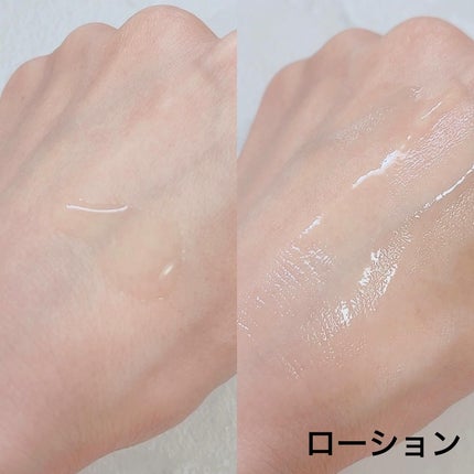 エテルナムトライアルキット(5日分)/エテルナム/トライアルキットを使ったクチコミ(4枚目)