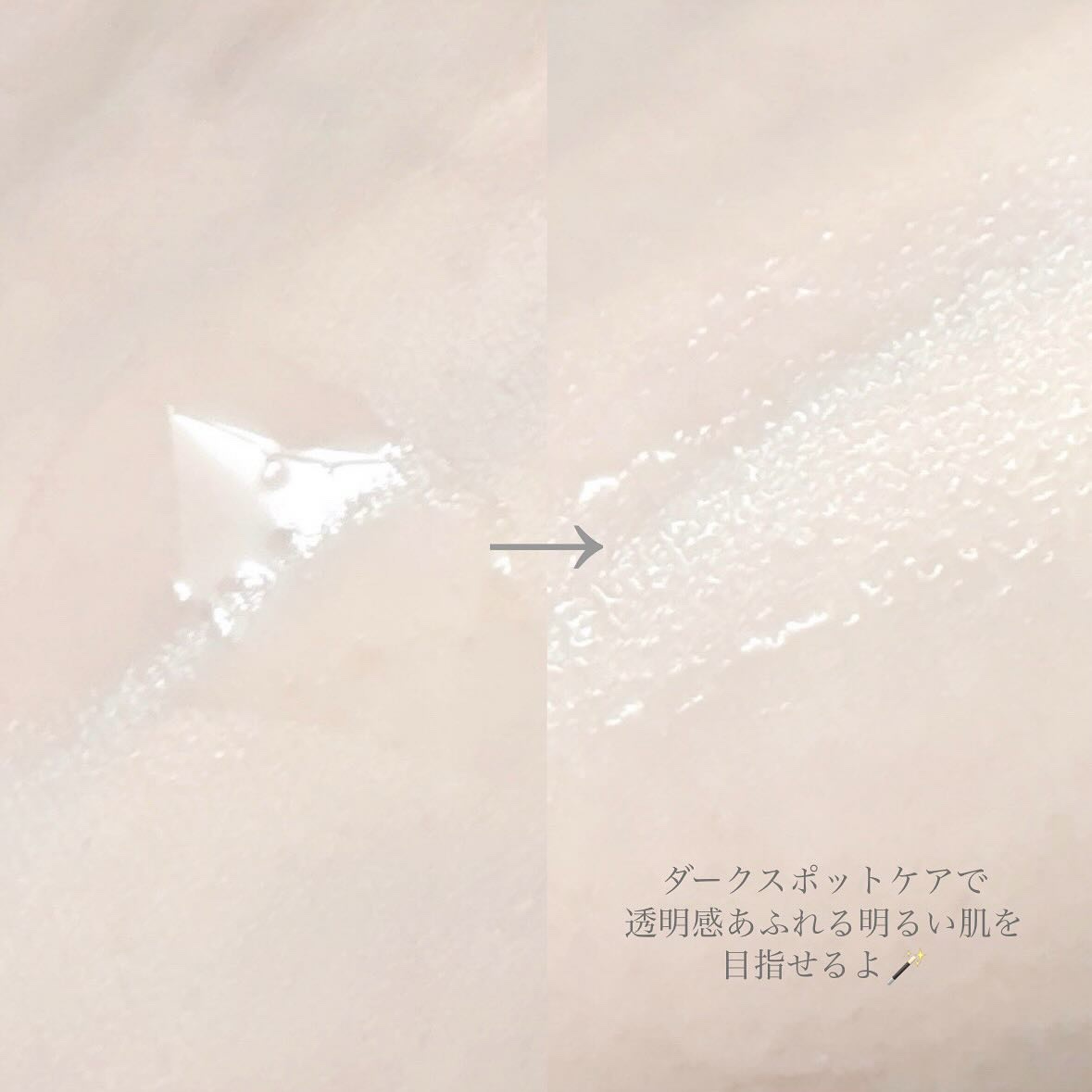 TXナイアシンエッセンストナー/SKIN&LAB/化粧水を使ったクチコミ（3枚目）