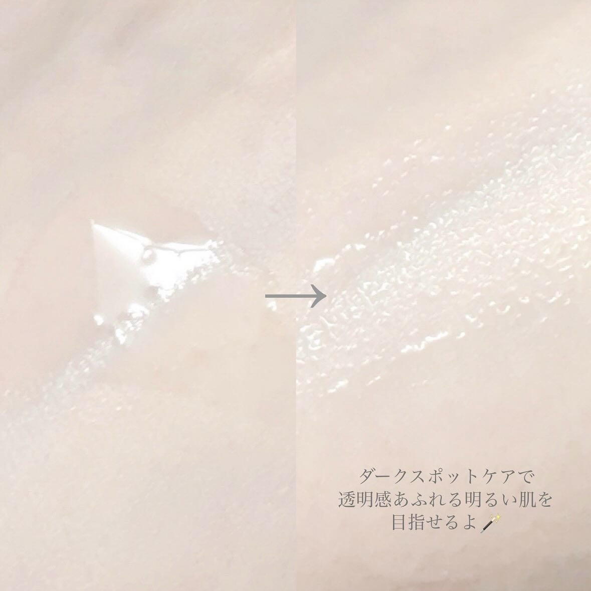 TXナイアシンエッセンストナー/SKIN&LAB/化粧水を使ったクチコミ(3枚目)