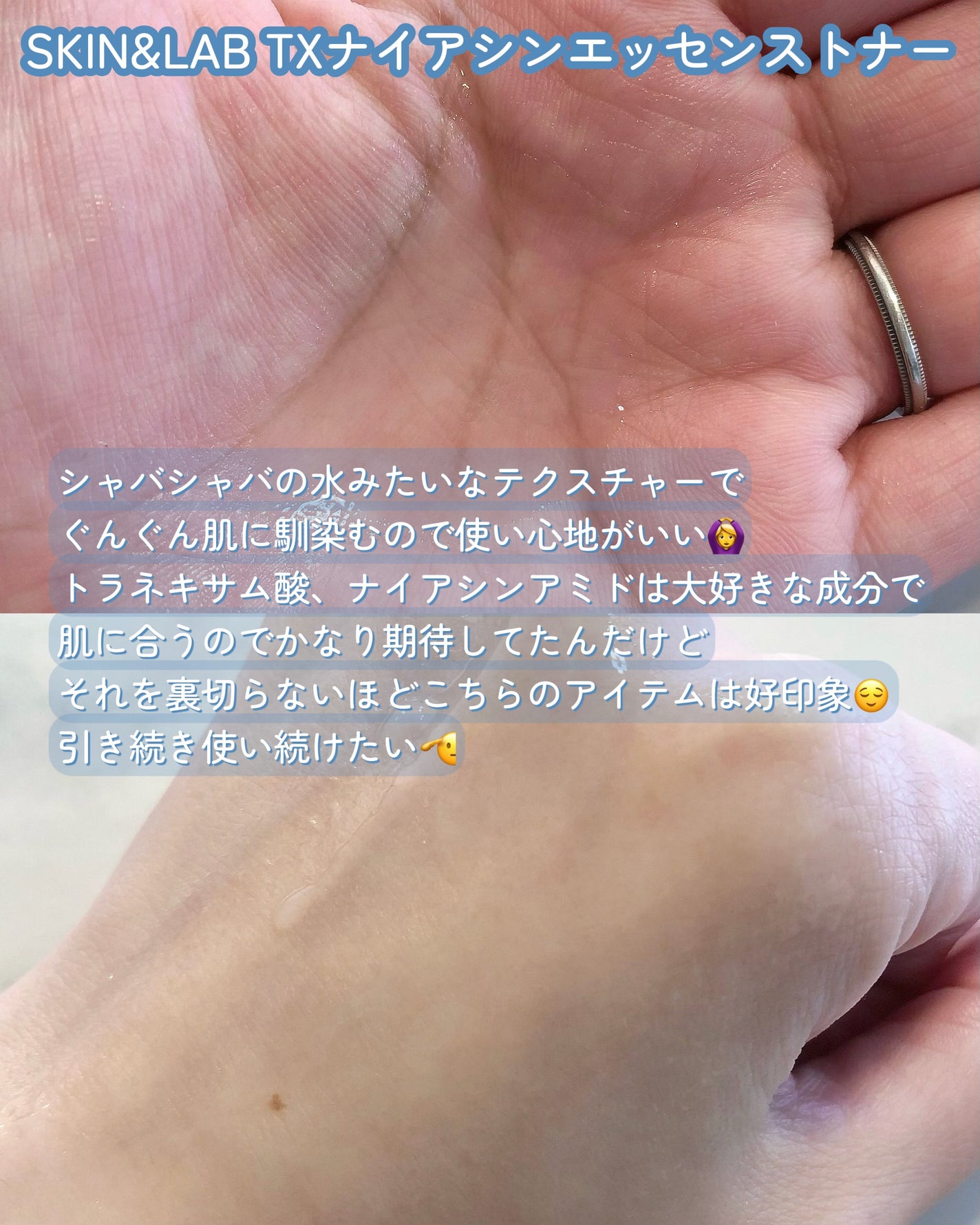 TXナイアシンエッセンストナー/SKIN&LAB/化粧水を使ったクチコミ(3枚目)