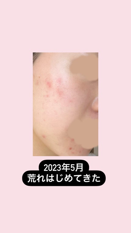 カラーミキシングコンシーラー/キャンメイク/パレットコンシーラーを使ったクチコミ(3枚目)