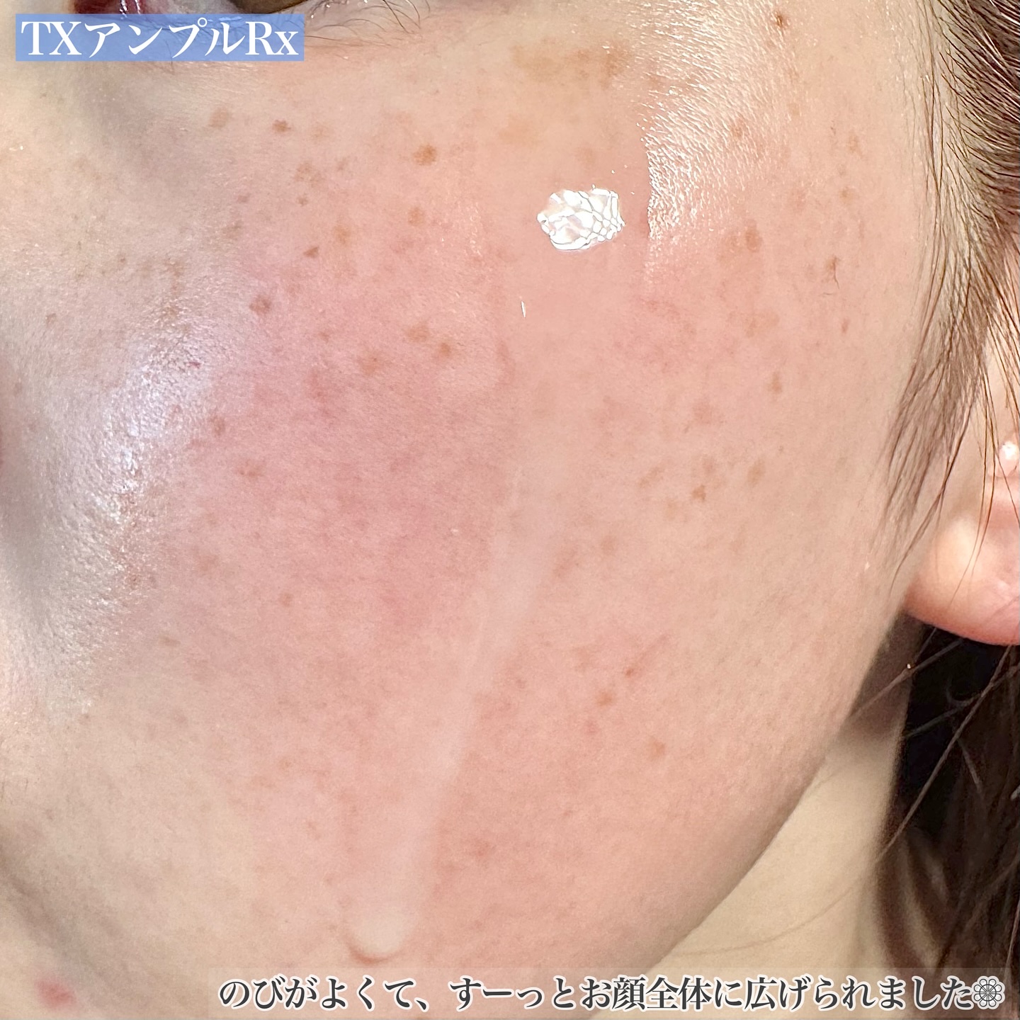 TXアンプルRX＋TXクリーム/Dr.Melaxin/スキンケアキットを使ったクチコミ（3枚目）