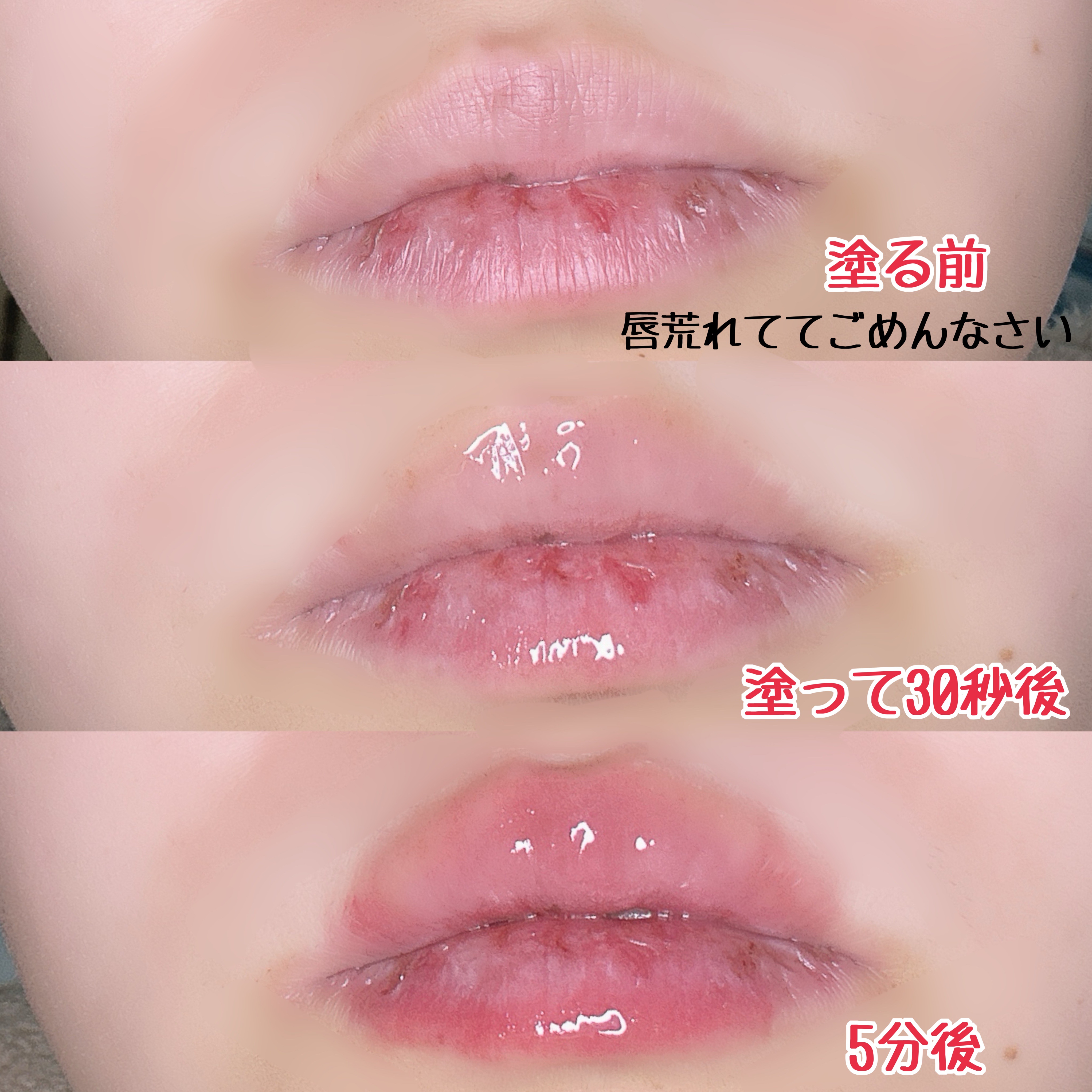 ウォーターフルリッププランパー/COSNORI/リッププランパーを使ったクチコミ（3枚目）