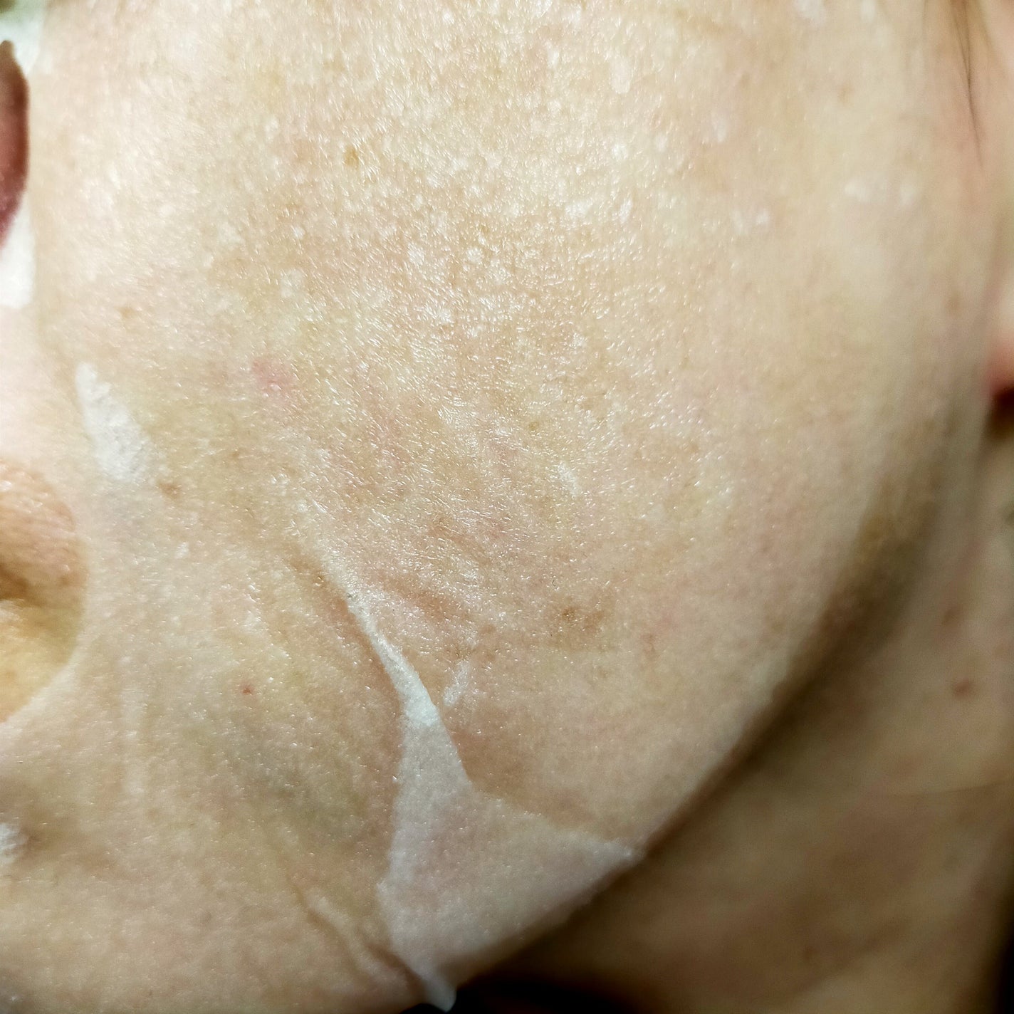 PDRNデイリーマスクパック/COSNORI/その他スキンケアを使ったクチコミ(3枚目)