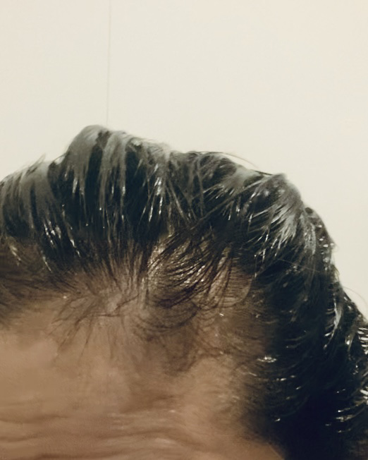 ディープダメージトリートメントEX/UNOVE/洗い流すヘアトリートメントを使ったクチコミ（3枚目）