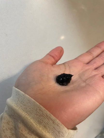 BLACK JELLY WASH(ブラックジェリーウォッシュ)/PLUEST/その他洗顔料を使ったクチコミ(2枚目)