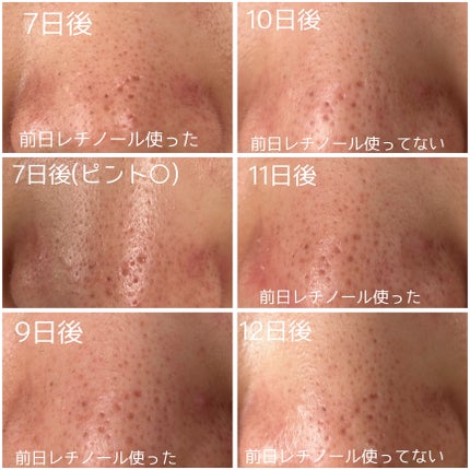 レチノール0.3 ナイアシンリニューイングセラム/Anua/美容液を使ったクチコミ(6枚目)