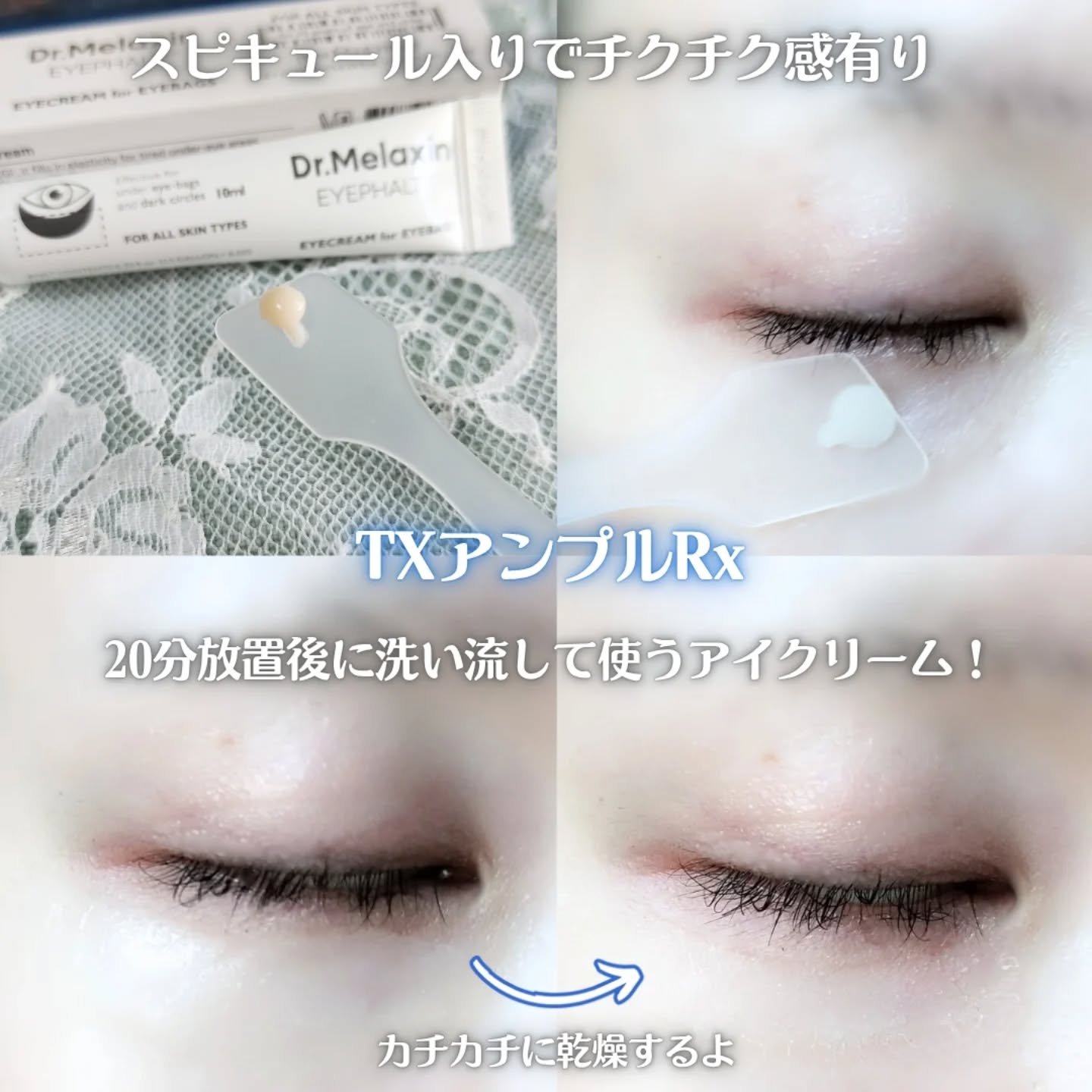 アイファルトアイバッククリーム/Dr.Melaxin/アイケア・アイクリームを使ったクチコミ（3枚目）