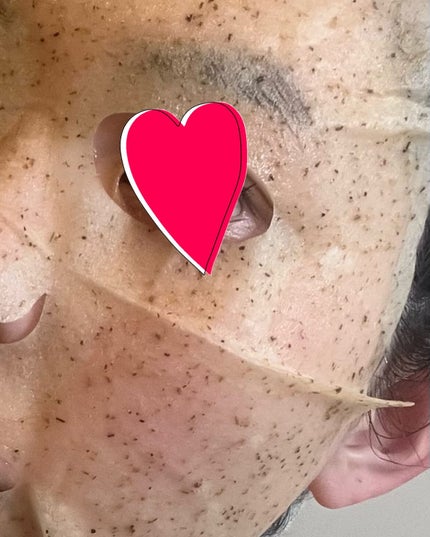 ツボクサスージングハイドロヨモギマスク/LIALUSTER/シートマスク・パックを使ったクチコミ(3枚目)