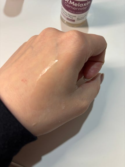 セメンリトカルシウムアンプル+セメンリトカルシウムクリーム/Dr.Melaxin/スキンケアキットを使ったクチコミ(2枚目)