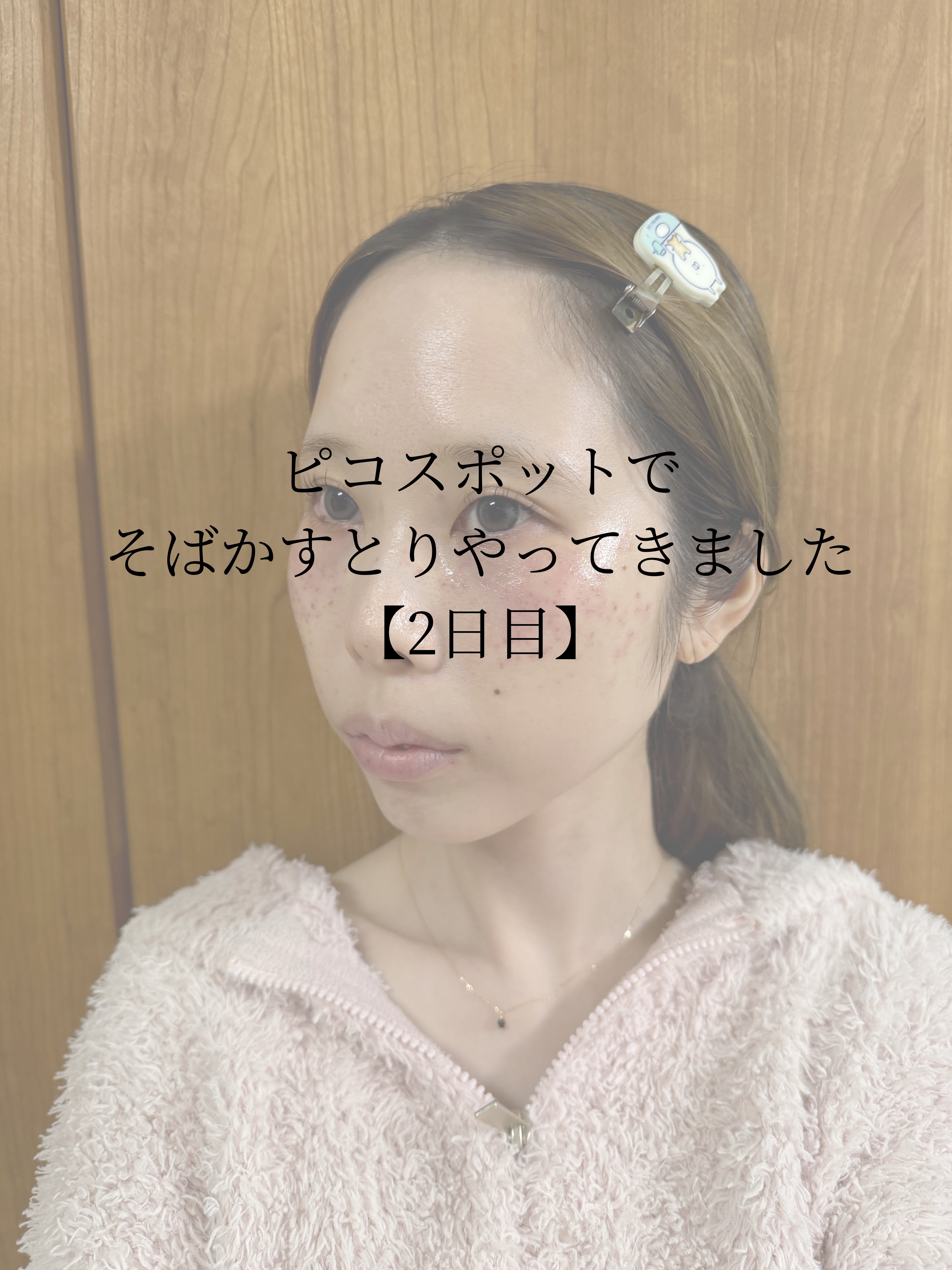 トイロ バランシングミルク＜医薬部外品＞（乳液）/ファンケル/乳液を使ったクチコミ（1枚目）