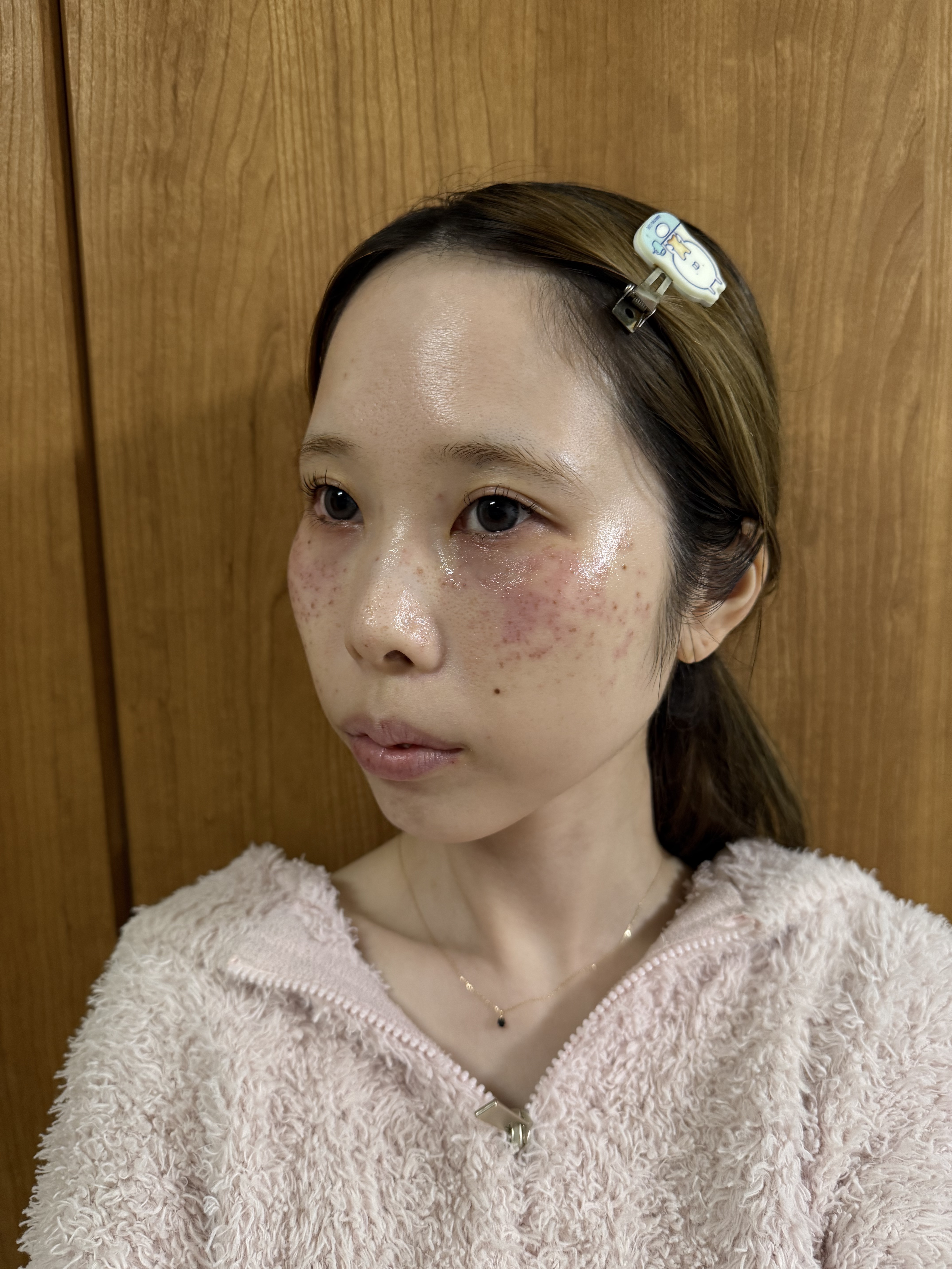 トイロ バランシングミルク＜医薬部外品＞（乳液）/ファンケル/乳液を使ったクチコミ（2枚目）