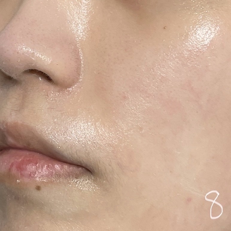 キソ REクリーム/KISO/フェイスクリームを使ったクチコミ（3枚目）