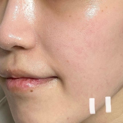 キソ REクリーム/KISO/フェイスクリームを使ったクチコミ(7枚目)