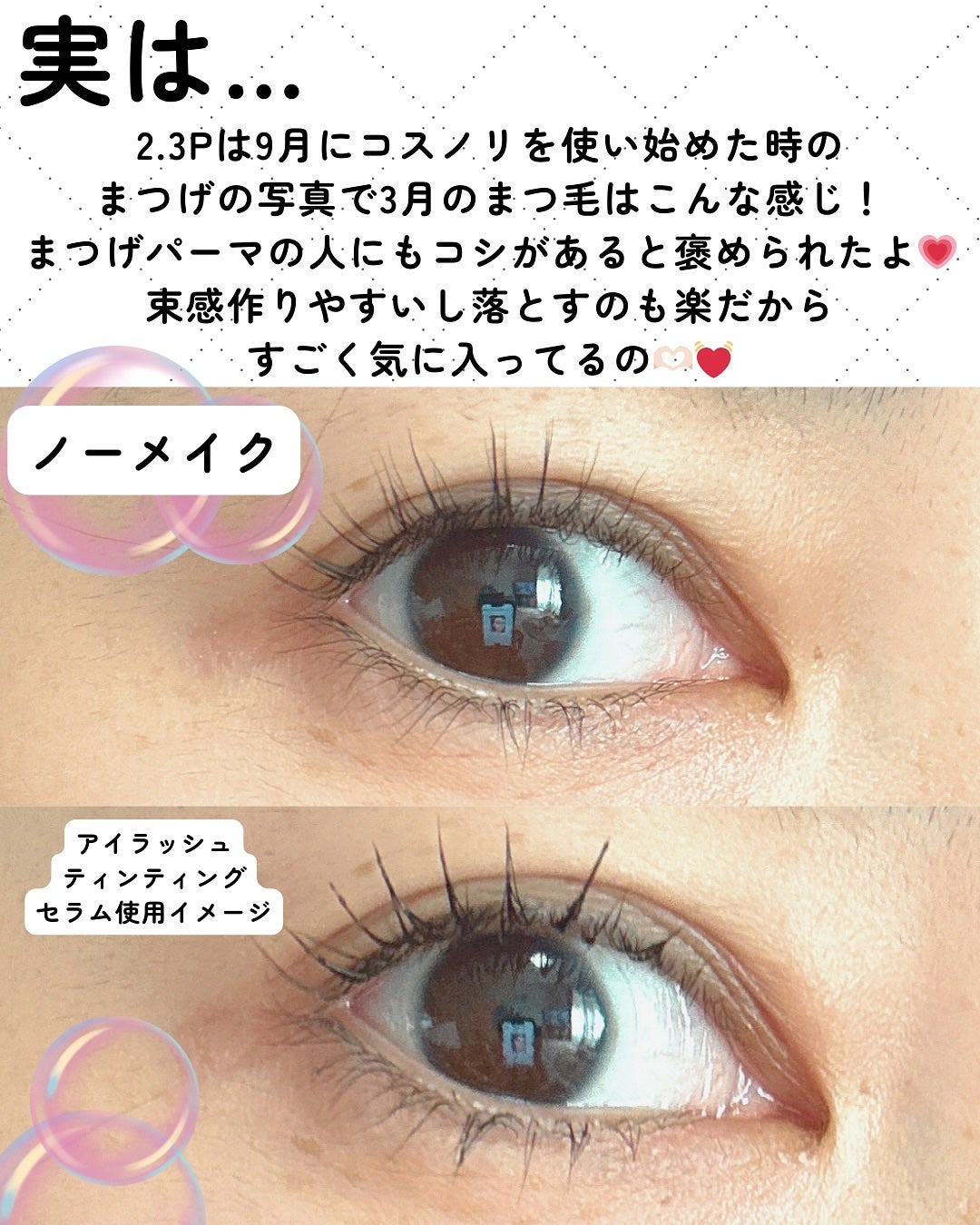 é±4çŒèð¿ãã©ãã100 on LIPS ãCOSNORIããŸãããã³ã°ã¢ã¯ãã£ãã¢ã€ã©ãã·ã¥ã»ã©ã ã¢ã€ã©..ãïŒ4æç®ïŒ