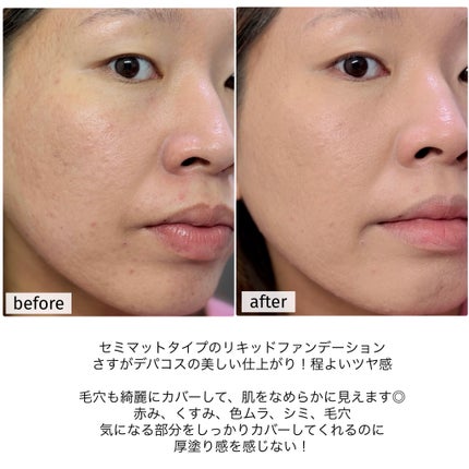 タンイドル ウルトラ ウェア リキッド N/LANCOME/リキッドファンデーションを使ったクチコミ(5枚目)