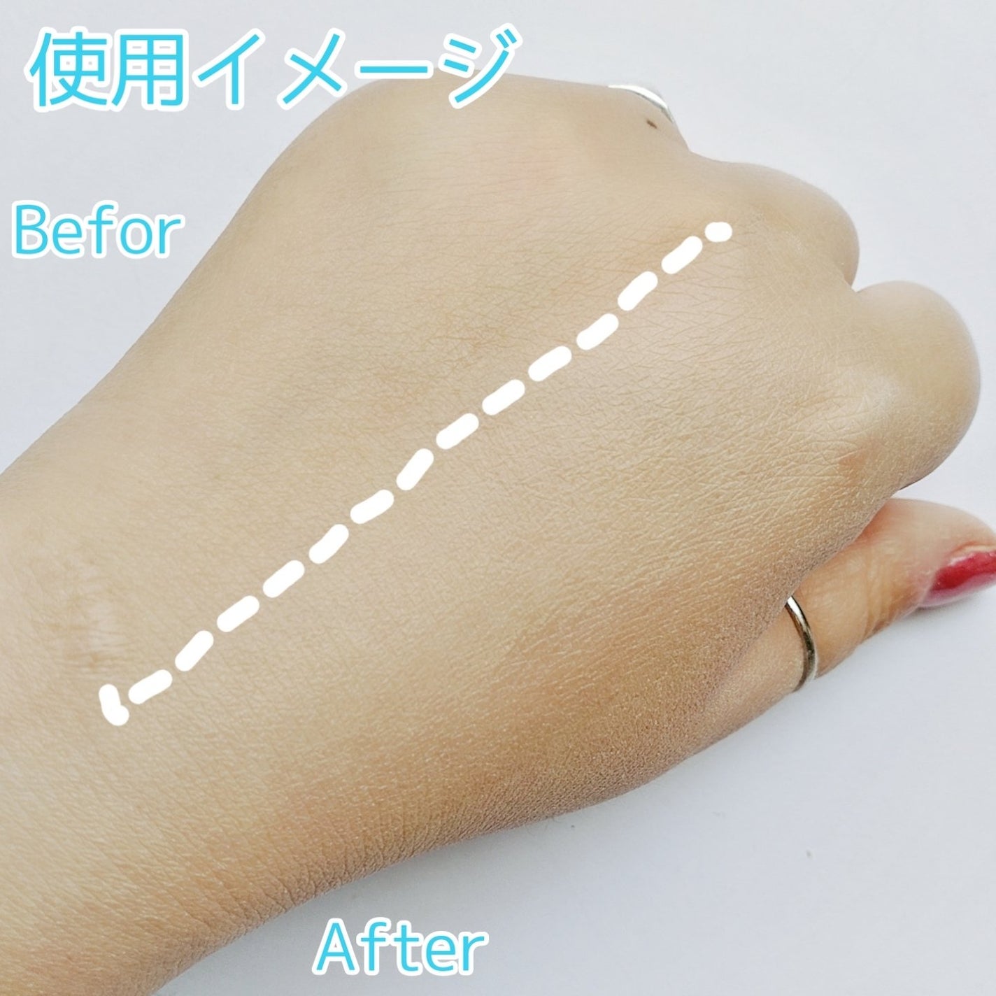 ãµã çŽ èèšå¿µæ¥ è¬çšã¹ãã³ã±ã¢ããŠã㌠ACãã¯ã€ããå»è¬éšå€åã/çŽ èèšå¿µæ¥/ãã¬ã¹ãããŠããŒã䜿ã£ãã¯ãã³ãïŒ7æç®ïŒ