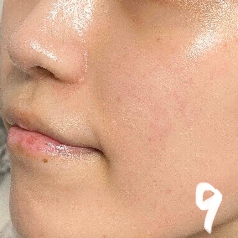 キソ REクリーム/KISO/フェイスクリームを使ったクチコミ(5枚目)