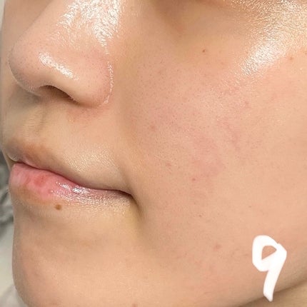 キソ REクリーム/KISO/フェイスクリームを使ったクチコミ(5枚目)