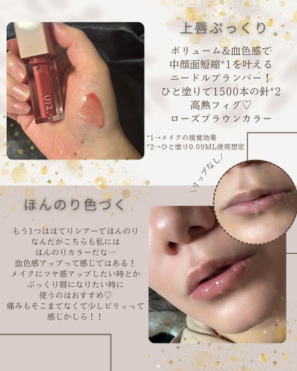 ニードルプランパー 高熱フィグ/Ui2./リッププランパーを使ったクチコミ(2枚目)