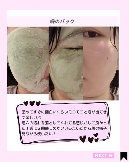 Kana on LIPS 「@kana.cosme2525🫧✨炭酸バブルクレイパックで毛穴..」(5枚目)
