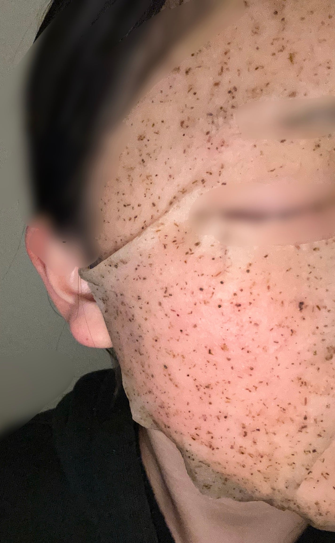 ツボクサスージングハイドロヨモギマスク/LIALUSTER/シートマスク・パックを使ったクチコミ(3枚目)