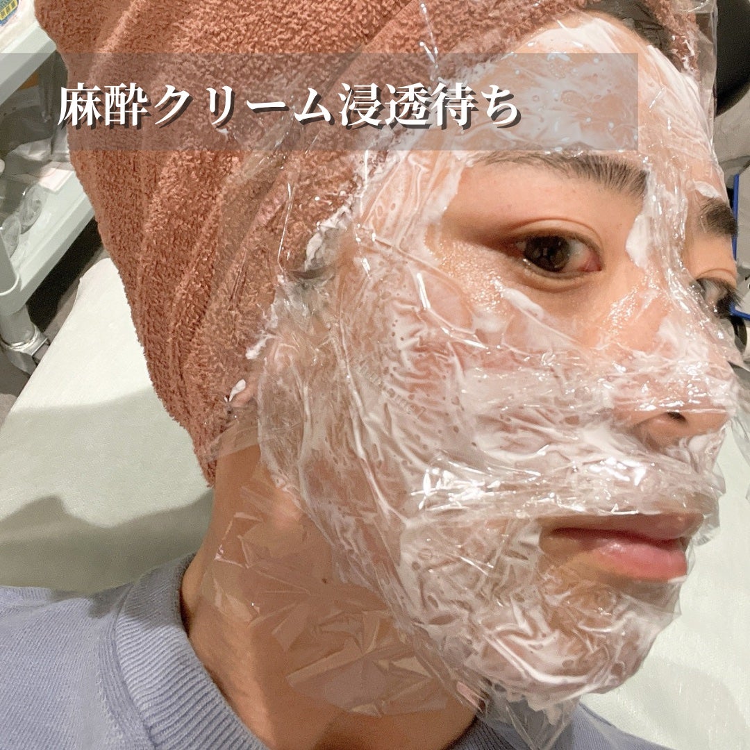 ã¹ã·ãã ð£ on LIPS ããæ¯ç©ŽåŒãç· ãã»å°ãžã¯æ¹åã2025幎ã®çŸå®¹å»ç2æ¬ç®ããã€ã..ãïŒ2æç®ïŒ