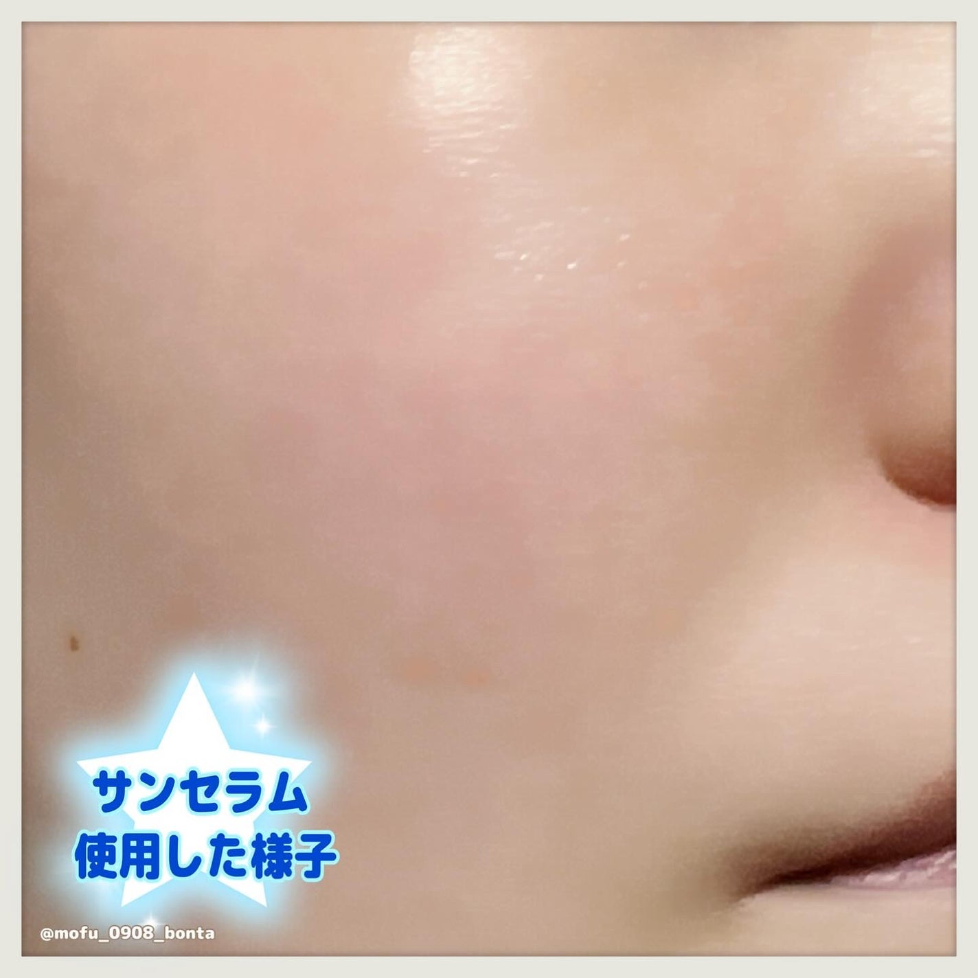 センテラ クイックカーミングパッド/SKIN1004/トナーパッドを使ったクチコミ(10枚目)