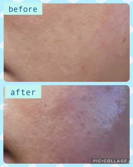 デイライト・エディション/MEDICUBE/スキンケアキットを使ったクチコミ(10枚目)