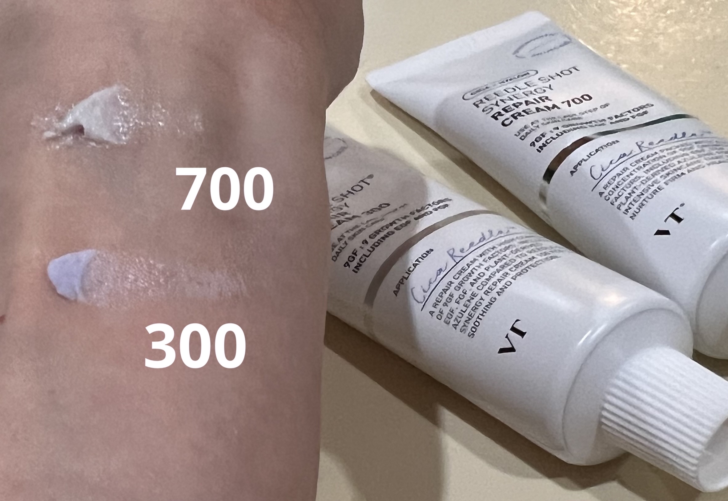 リードルショット シナジー リペアクリーム 300/VT/フェイスクリームを使ったクチコミ（2枚目）