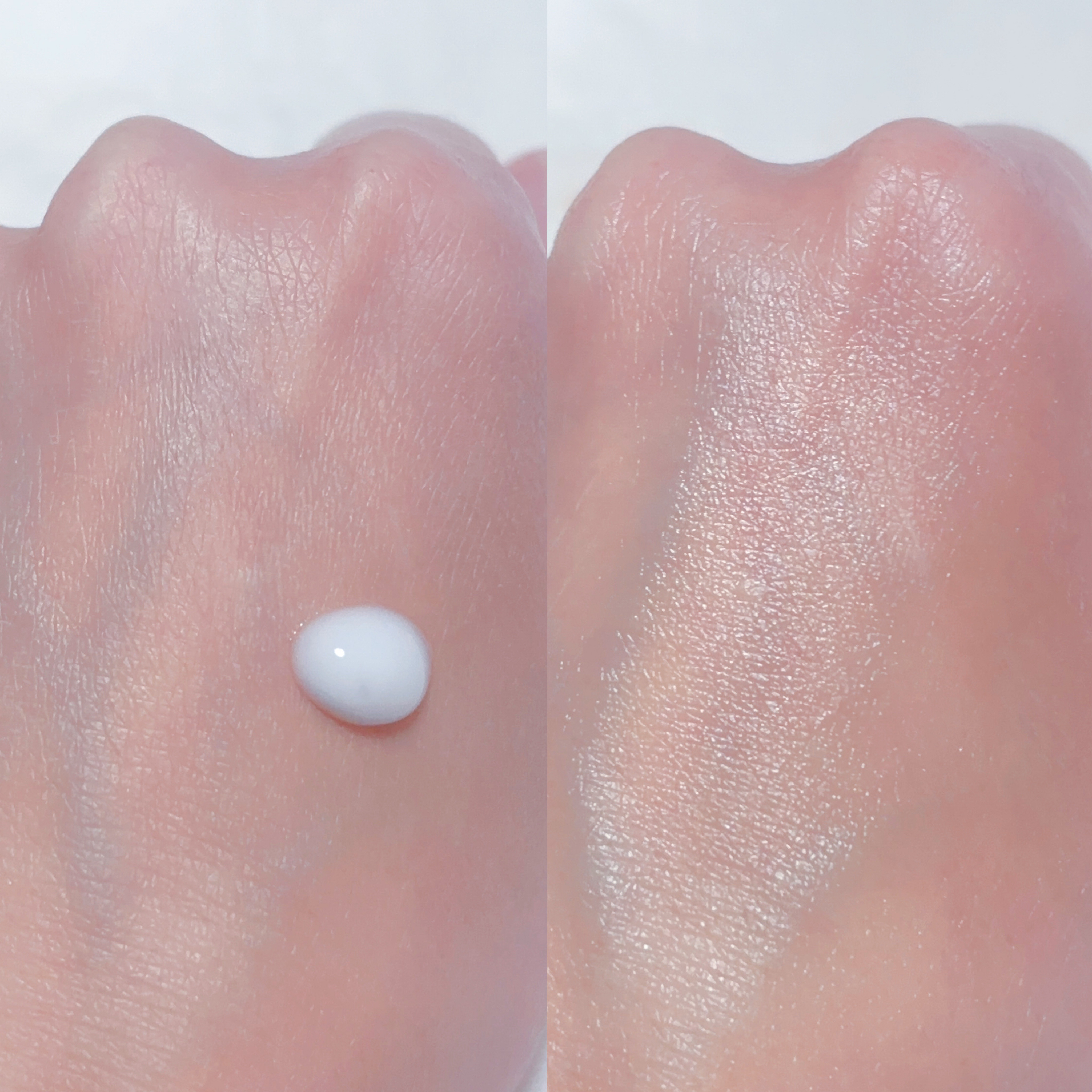 ニードルセラムＡＸ４/fractionalCC/美容液を使ったクチコミ（3枚目）