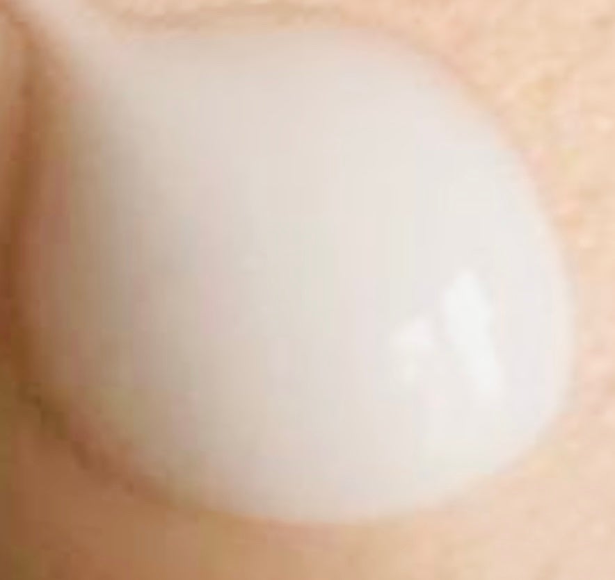 ミノン アミノモイスト 薬用アクネケア ミルク/ミノン/乳液を使ったクチコミ(2枚目)